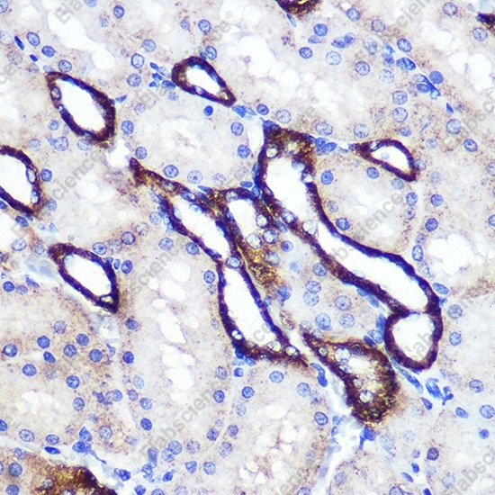 SIRT2 Polyclonal Antibody - 5