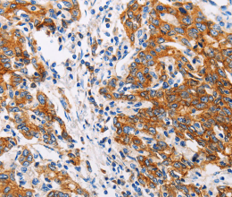 CTNNA1 Polyclonal Antibody - 2