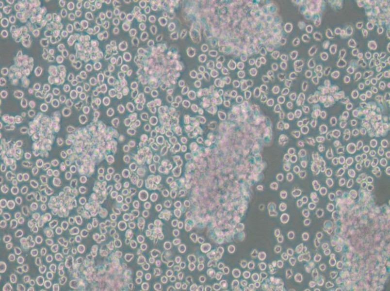 Granta-519 Cell Complete Medium - 6