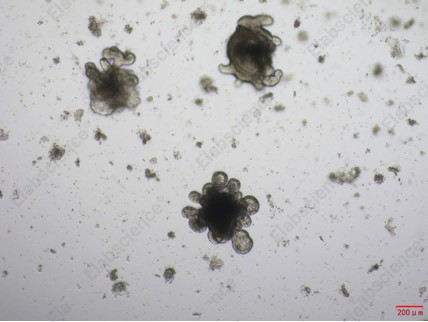 Recombinant Mouse Noggin/NOG Protein (His Tag) - 3