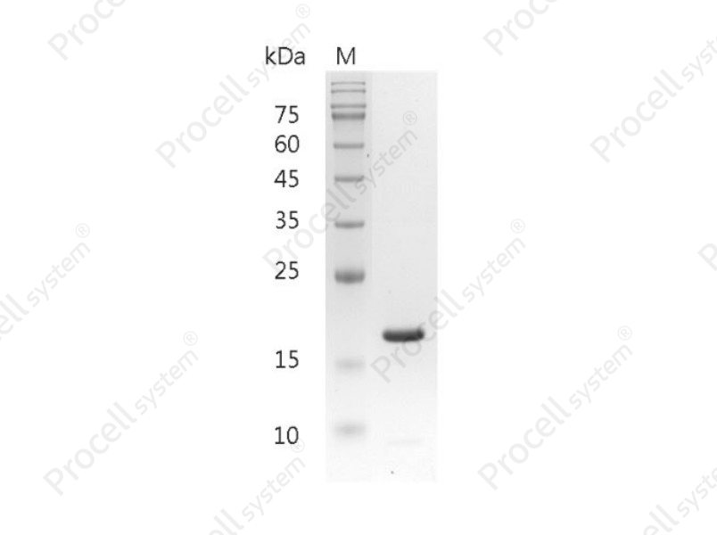 IL-1&beta;/IL1F2, Mouse, Recombinant