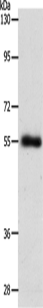 Western Blot analysis of Mouse lung tissue using SLC1A5 Polyclonal Antibody at dilution of 1:600