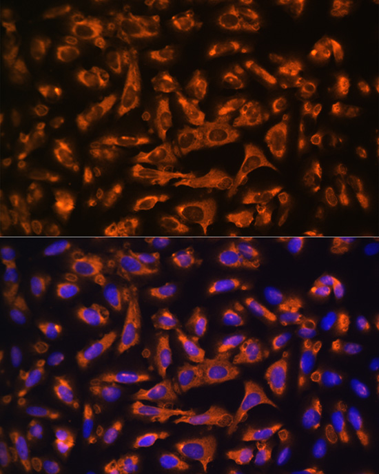 Immunofluorescence analysis of U2OS cells using DAG1 Polyclonal Antibody at dilution of 1:100 (40x lens). Blue: DAPI for nuclear staining.