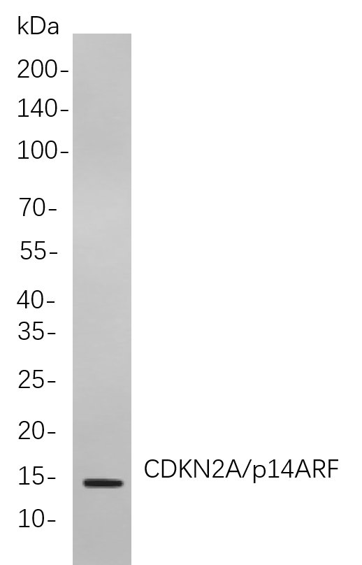 Recombinant CDKN2A/p14ARF Monoclonal Antibody-searchlist-1