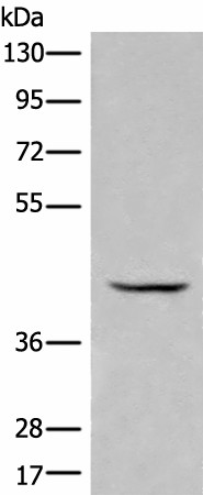 Western blot analysis of Human kidney tissue lysate  using BBOX1 Polyclonal Antibody at dilution of 1:650