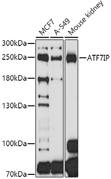 Western blot analysis of extracts of various cell lines using ATF7IP Polyclonal Antibody at 1:1000 dilution.