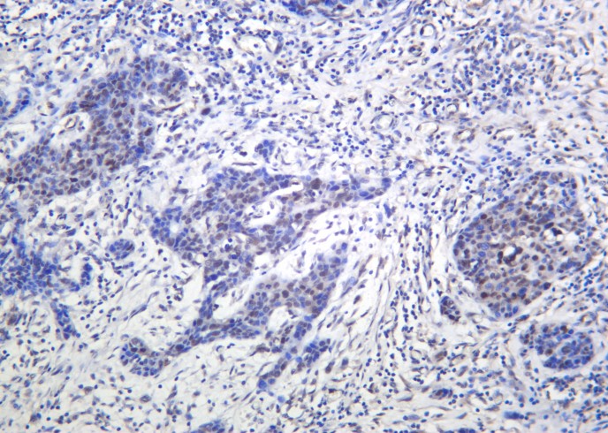 Recombinant Phospho-ATM (Ser1981) Monoclonal Antibody - small - 2