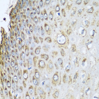 Immunohistochemistry of paraffin-embedded human esophagus using Prohibitin 2 (Prohibitin 2 (PHB2)) Polyclonal Antibody at dilution of 1:100 (40x lens).Perform microwave antigen retrieval with 10 mM PBS buffer pH 7.2 before commencing with IHC staining protocol.