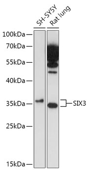 Western blot analysis of extracts of various cell lines using SIX3 Polyclonal Antibody at 1:1000 dilution.