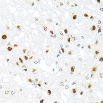 Immunohistochemistry of paraffin-embedded Rat brain using GATA2 Polyclonal Antibody at dilution of 1:100 (40x lens).