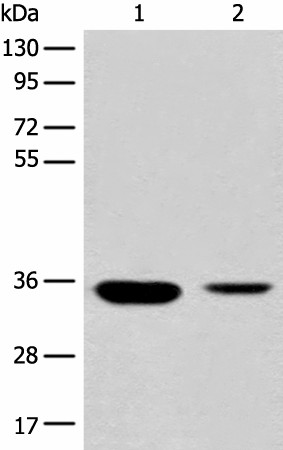 Western blot analysis of Mouse liver tissue and Human fetal liver tissue lysates  using RGN Polyclonal Antibody at dilution of 1:500