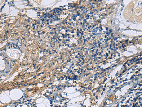 Immunohistochemistry of paraffin-embedded Human tonsil tissue  using PROC Polyclonal Antibody at dilution of 1:100(?200)