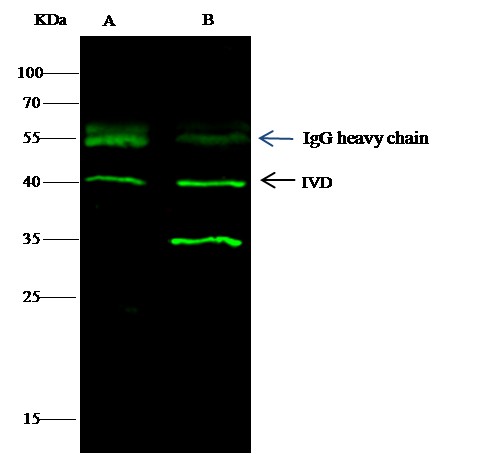 Isovaleryl-CoA dehydrogenase/IVD Monoclonal Antibody - small - 3