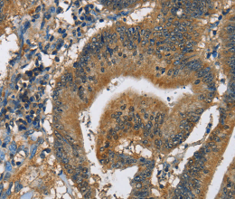 CAST Polyclonal Antibody - 3
