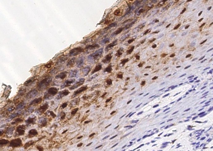 Cystatin A/CSTA Monoclonal Antibody - small - 3