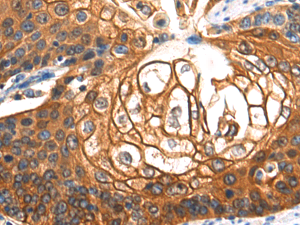 SERPINB5 Polyclonal Antibody - 2