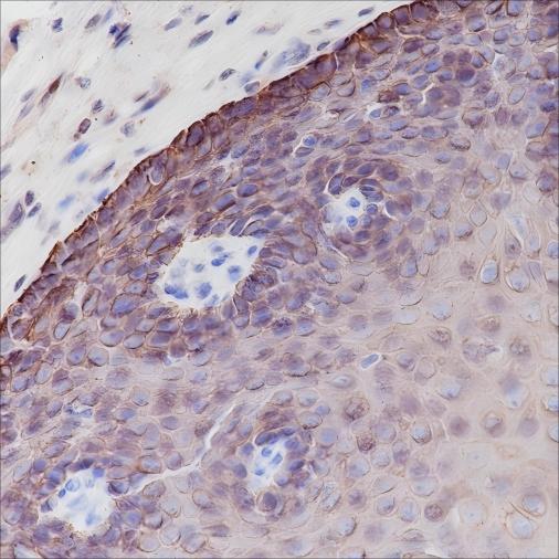 Recombinant Keratin 6 Monoclonal Antibody - small - 3