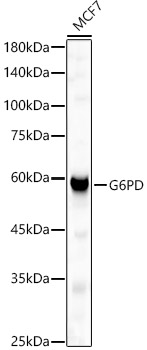 Western blot analysis of MCF7 using G6PD Polyclonal Antibody at 1:500 dilution.