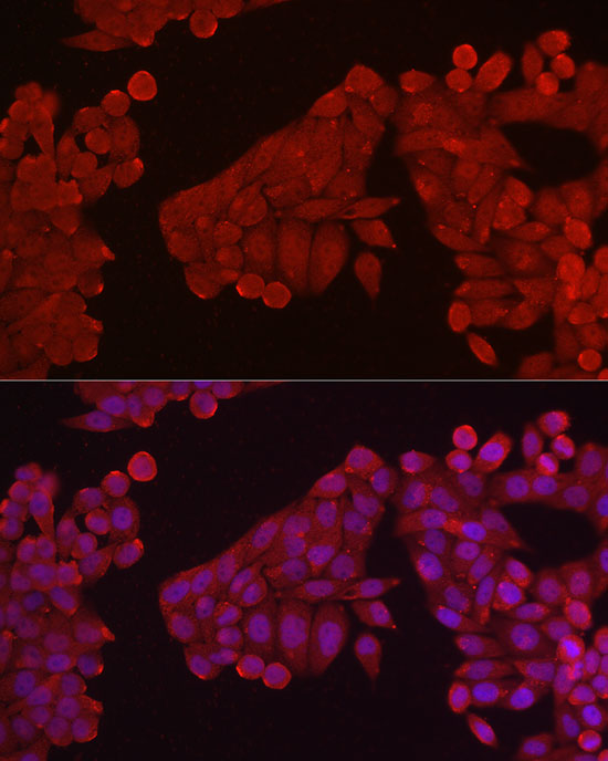 Immunofluorescence analysis of HeLa cells using HK3 Polyclonal antibody at dilution of 1:150 (40x lens). Blue: DAPI for nuclear staining.