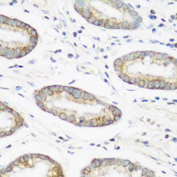 Immunohistochemistry of paraffin-embedded Human gastric using NEDD4 Polyclonal Antibody at dilution of  1:200 (40x lens).