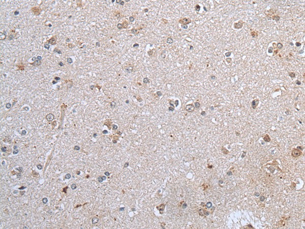 Immunohistochemistry of paraffin-embedded Human brain tissue  using CLDN12 Polyclonal Antibody at dilution of 1:45(?200)