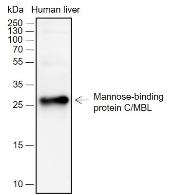 Recombinant MBL2 Monoclonal Antibody - 2