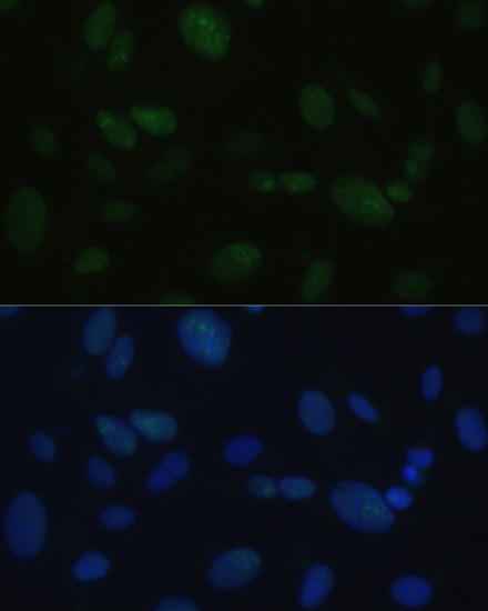Immunofluorescence analysis of U-2OS cells using PRKDC Polyclonal Antibody at dilution of 1:100. Blue: DAPI for nuclear staining.