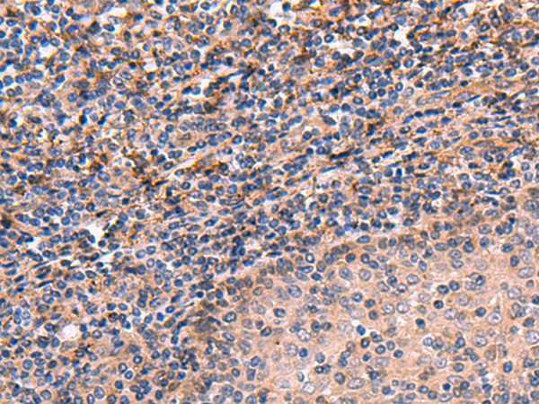 Immunohistochemistry of paraffin-embedded Human tonsil tissue  using ARIH2 Polyclonal Antibody at dilution of 1:70(?200)