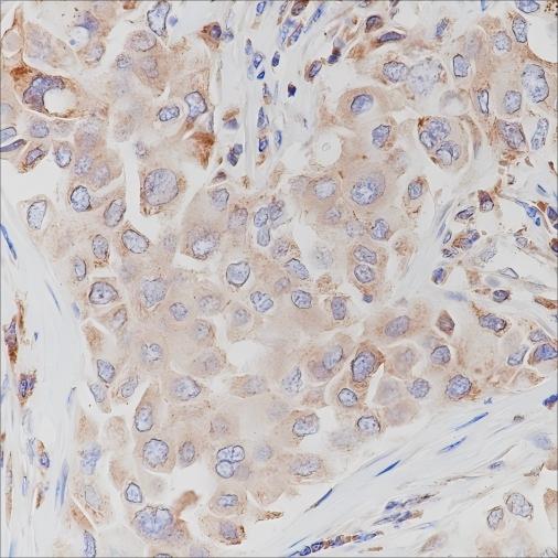 Recombinant c-erbB-3/HER-3 Monoclonal Antibody - small - 2