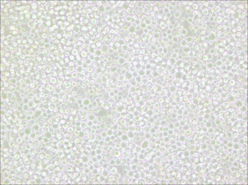 OKT 11 Cell Complete Medium - 5