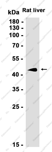 Recombinant ASS1 Monoclonal Antibody - 3