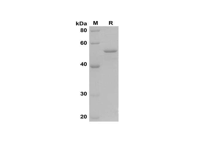 Recombinant Human TNF-α Protein(Gst Tag)-产品推荐-1
