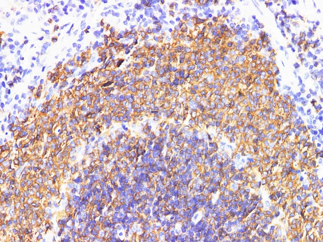 Purified Anti-Human CD4 Antibody[SK3]-产品推荐-1