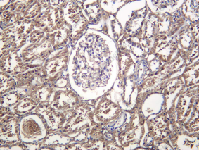 Recombinant COL6A2 Monoclonal Antibody - 2