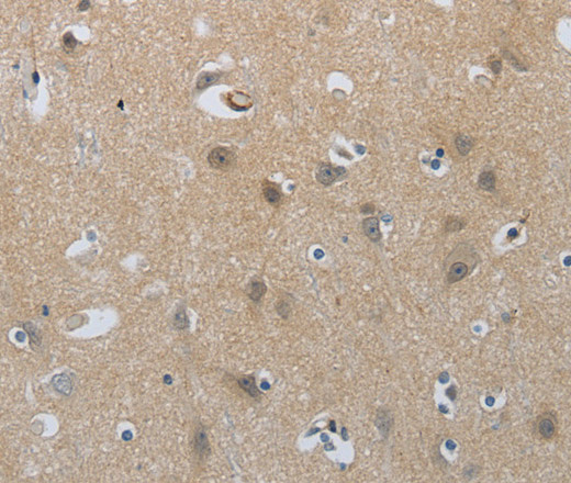 Immunohistochemistry of paraffin-embedded Human brain tissue using NPR1 Polyclonal Antibody at dilution of 1:30