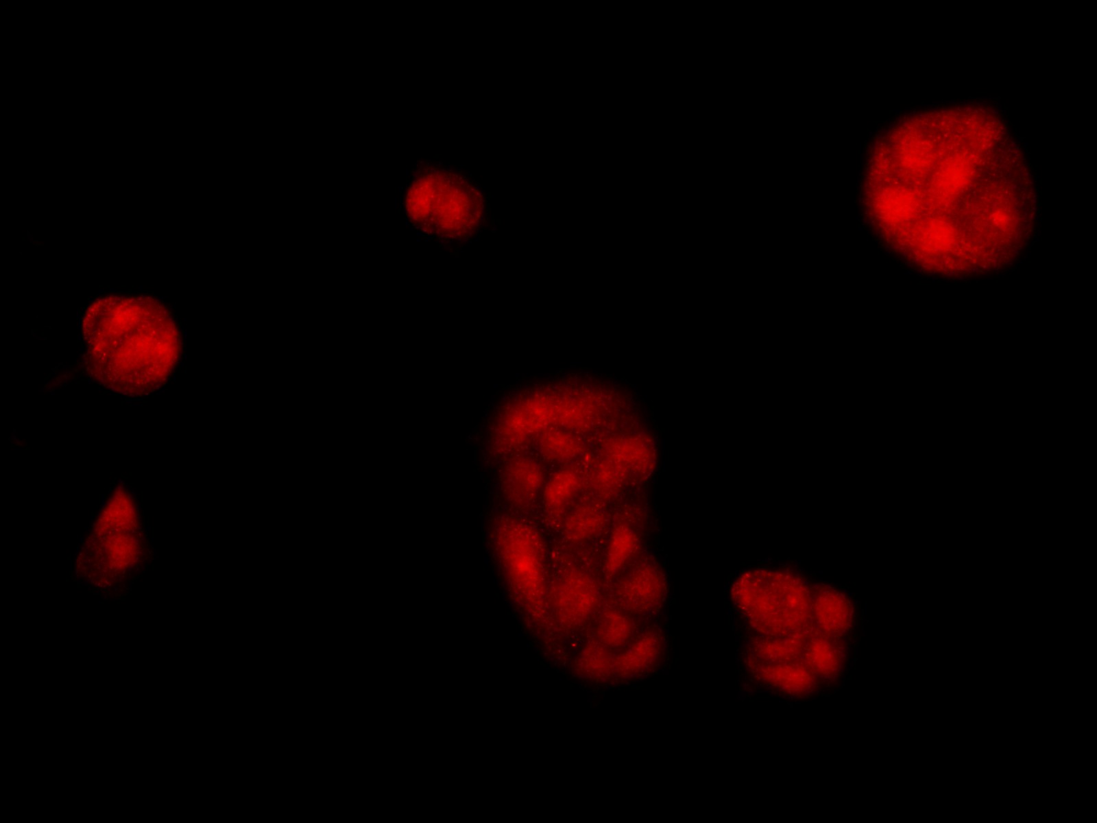 Immunofluorescence analysis of McF7 cells using BRCA1 Polyclonal Antibody at dilution of 1:100