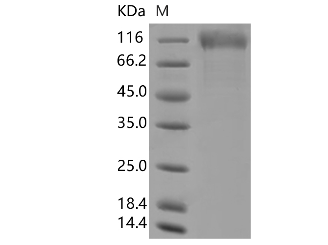 Immobilized Human ACE2 (mFc tag)(Cat: PKSH031870) at 2 ug/mL (100 uL/well) can bind SARS-CoV-2 (2019-nCoV) Spike S1(K417N, E484K, N501Y, D614G)-His(PKSV030361), the EC50 of PKSV030361 is 15-90 ng/mL.