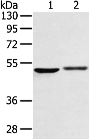 Western Blot analysis of Mouse intestinumm tenue tissue  using BMP4 Polyclonal Antibody at dilution of 1:450