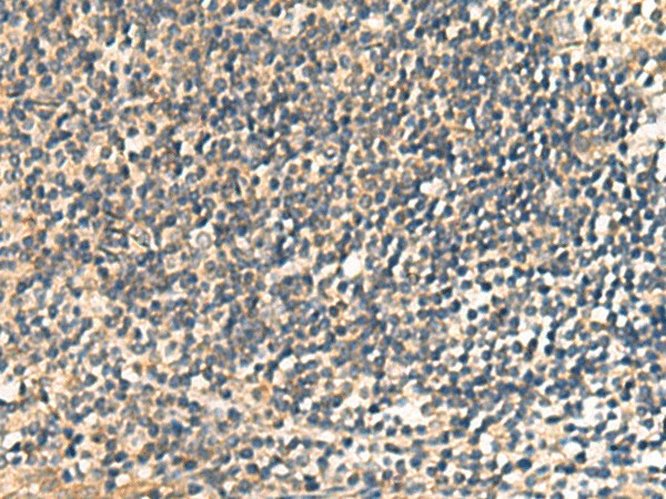 Immunohistochemistry of paraffin-embedded Human tonsil tissue  using CNST Polyclonal Antibody at dilution of 1:60(?200)