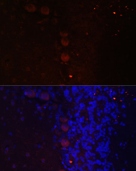 Immunofluorescence analysis of Rat brain using NEFM Polyclonal Antibody at dilution of  1:100. Blue: DAPI for nuclear staining.