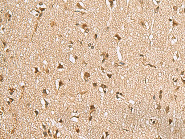 Immunohistochemistry of paraffin-embedded Human brain tissue  using NVL Polyclonal Antibody at dilution of 1:70(?200)