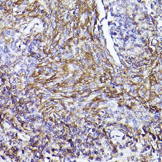 Immunohistochemistry of paraffin-embedded human tonsil using [KO Validated] CD73/NT5E Polyclonal antibody at dilution of 1:50 (40x lens).Perform high pressure antigen retrieval with 10 mM citrate buffer pH 6.0 before commencing with IHC staining protocol.