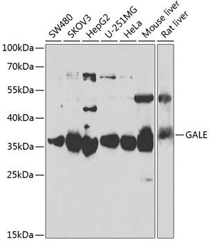 Western blot analysis of extracts of various cell lines using GALE Polyclonal Antibody at 1:1000 dilution.