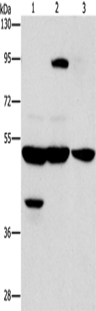 Western Blot analysis of Human bladder carcinoma tissue and A172 cell, Human brain malignant glioma tissue using STK4 Polyclonal Antibody at dilution of 1:1000