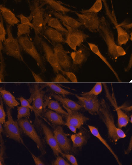 Immunofluorescence analysis of C6 cells using STUB1 Polyclonal Antibody at dilution of  1:100 (40x lens). Blue: DAPI for nuclear staining.