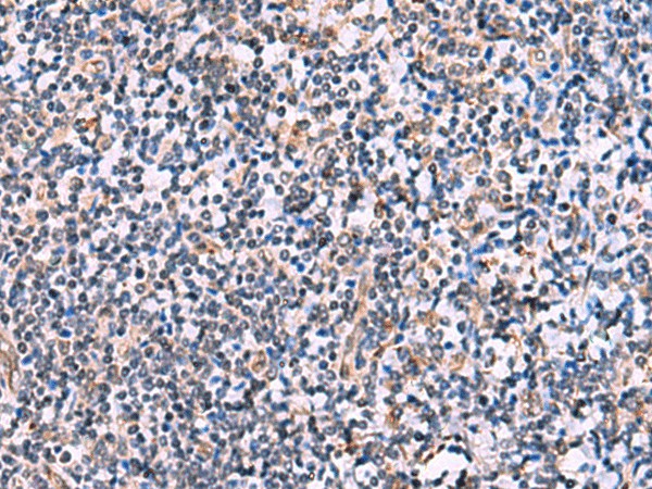 Immunohistochemistry of paraffin-embedded Human tonsil tissue  using NMRK2 Polyclonal Antibody at dilution of 1:55(?200)