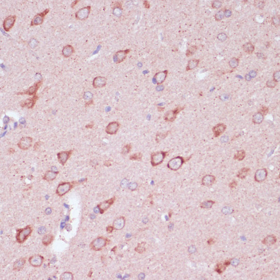 Immunohistochemistry of paraffin-embedded Rat brain using TOLLIP Polyclonal Antibody at dilution of  1:100 (40x lens).