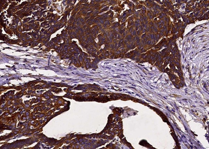 Recombinant FCGRT & B2M Heterodimer Monoclonal Antibody - small - 3
