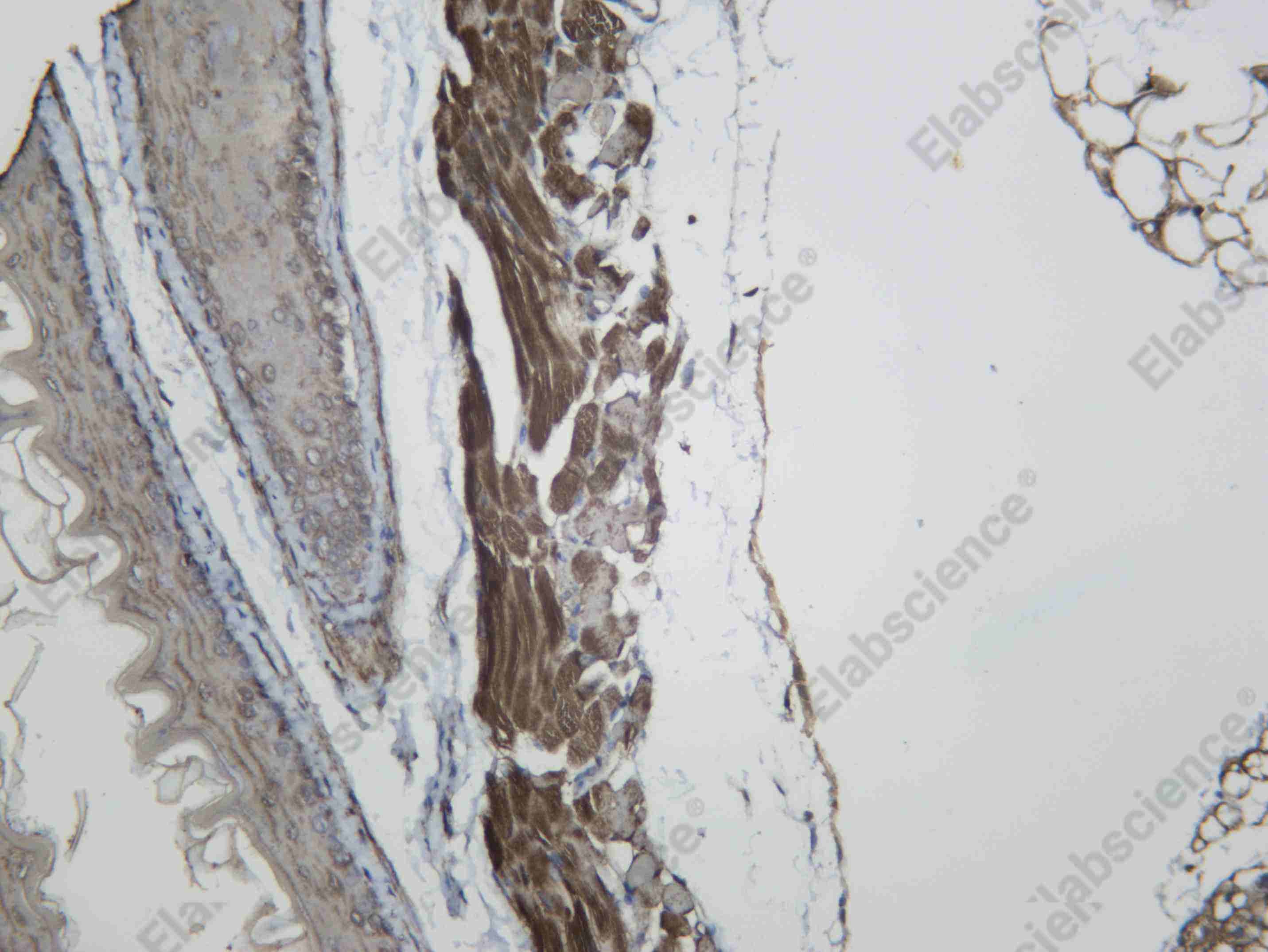 Recombinant VPRBP Monoclonal Antibody - 3