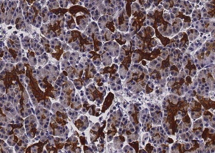 Recombinant Ephrin-A1/EFNA1 Monoclonal Antibody-searchlist-1